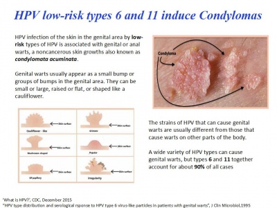 hpv 6 11 condyloma anti parasite foods